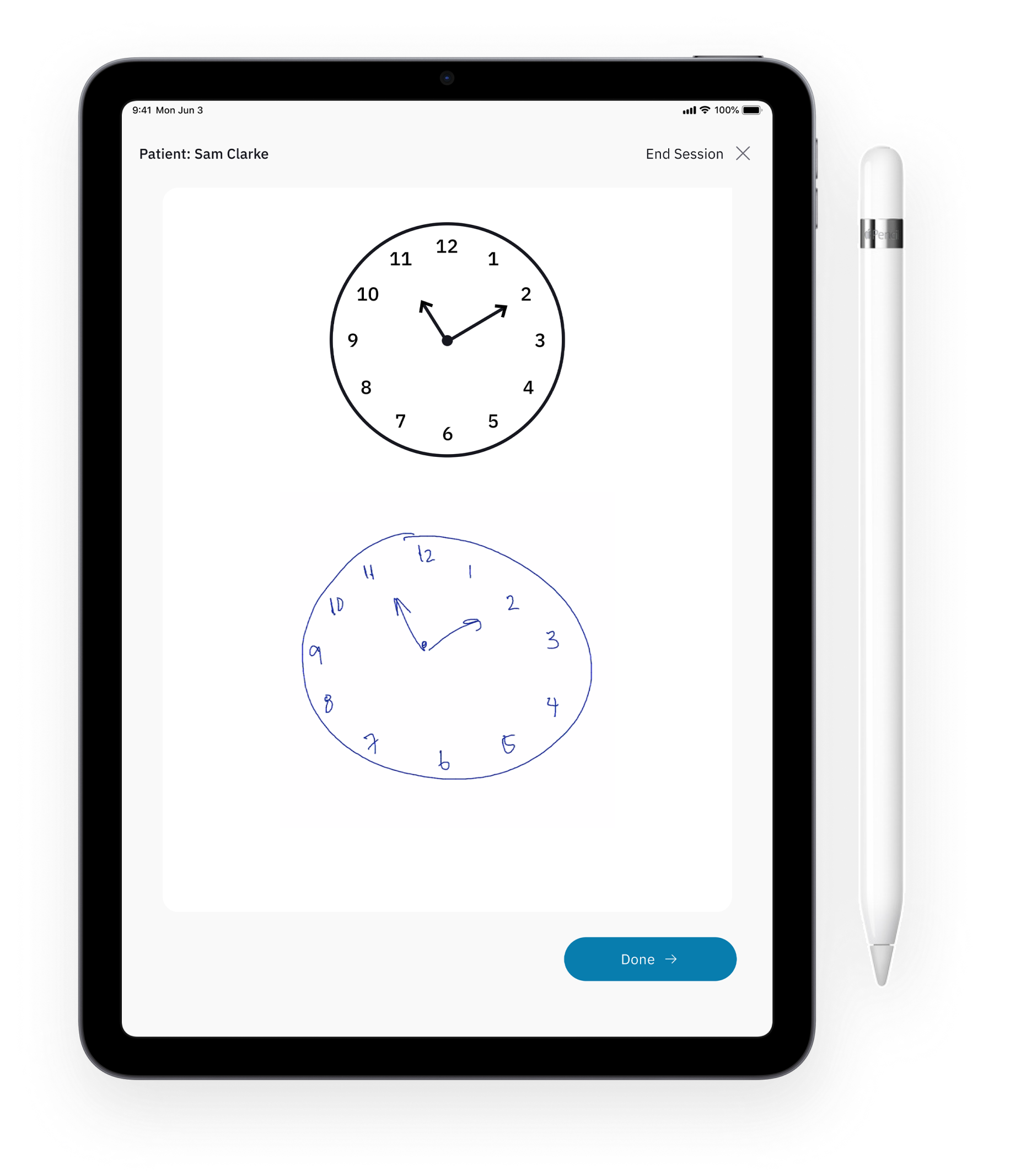 iPad showing the digital clock drawing test for Alzheimers and other dementias. This advanced cognitive test builds upon the scientifically validated traditional cognitive test but combining the clock drawing test with word recall tasks. This cognitive impairment test platform integrates with modern EHR systems and can detect early signs of Alzheimer's and other dementias